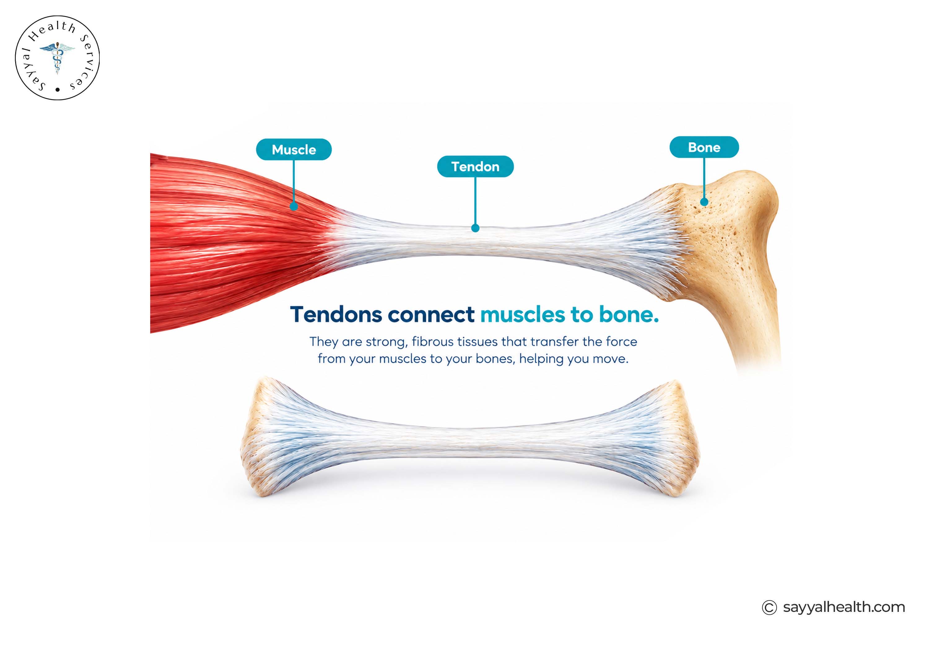 what are tendon injuries?